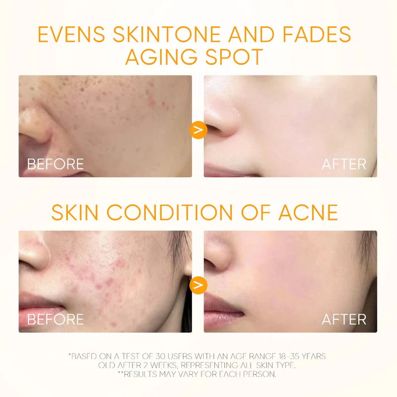 10% Vitamin C Brightening Serum