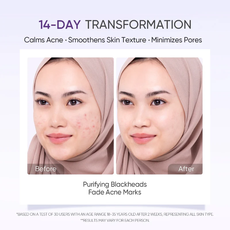 Peeling Lactic Acid Skin Renewal Exfoliating Serum