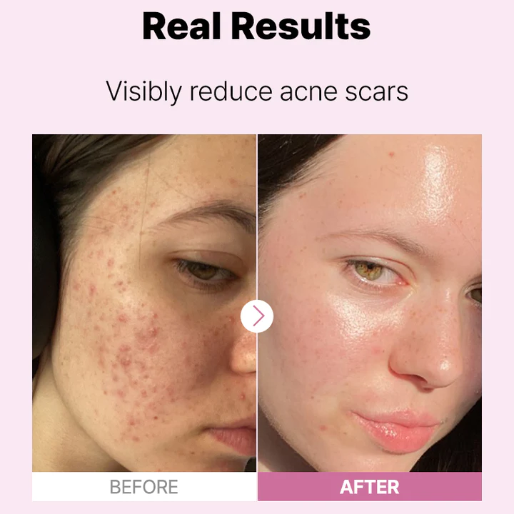 The Niacinamide 15 Serum