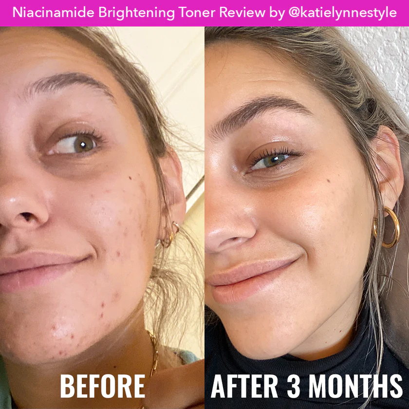 NIACINAMIDE BRIGHTENING TONER