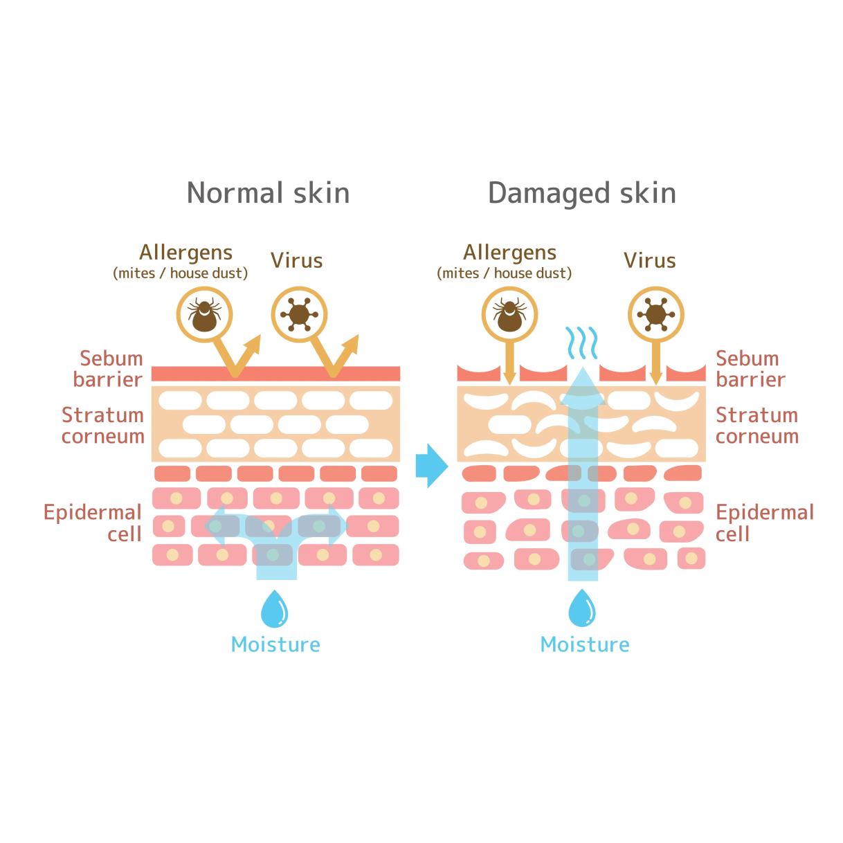 What is Skin Barrier? How to protect it.